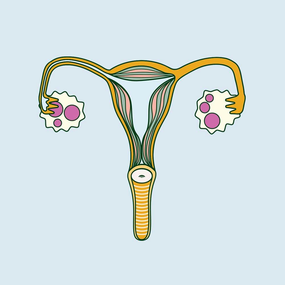 Is It Time To Change The Way We Discuss And Diagnose PCOS?